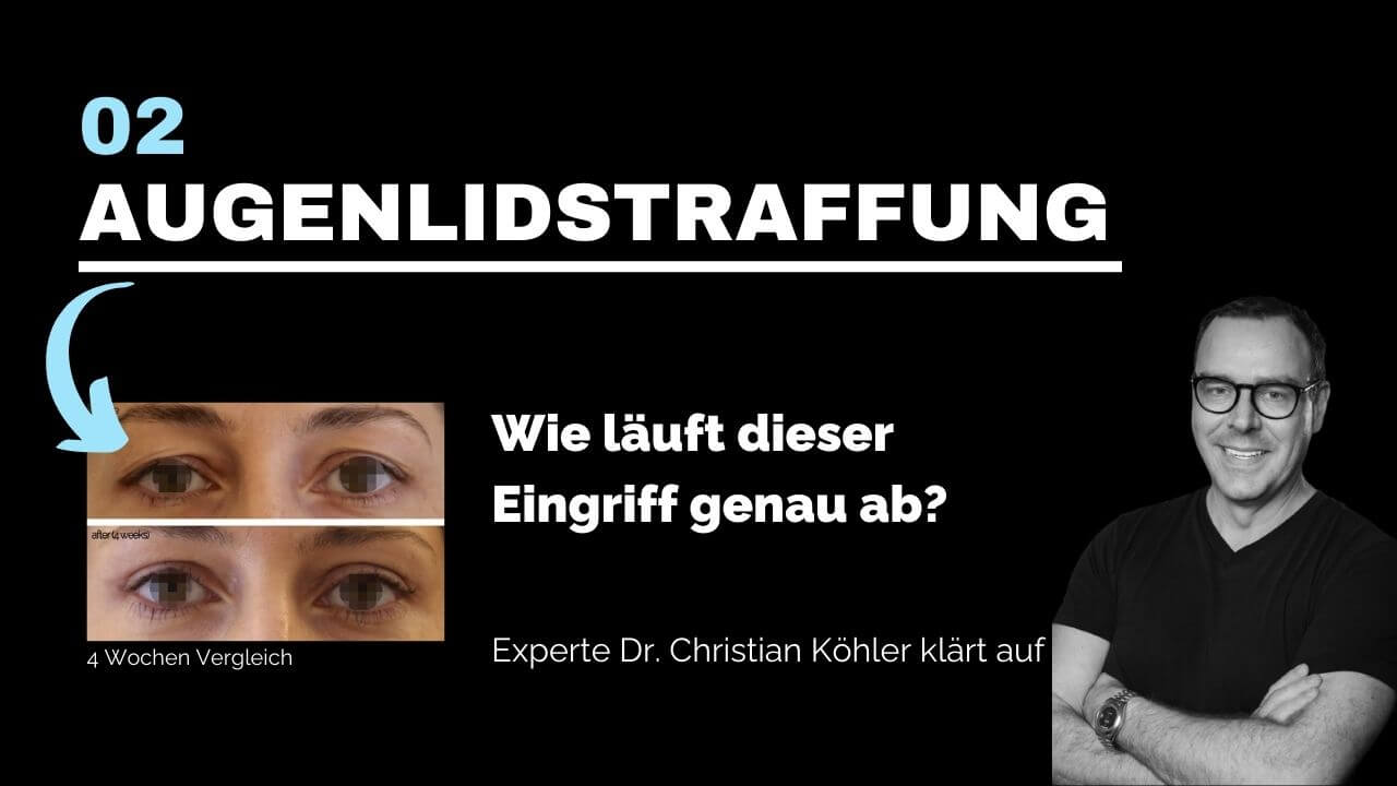Augenlidstraffung, prevention-center für Schönheitschirurgie in Zug