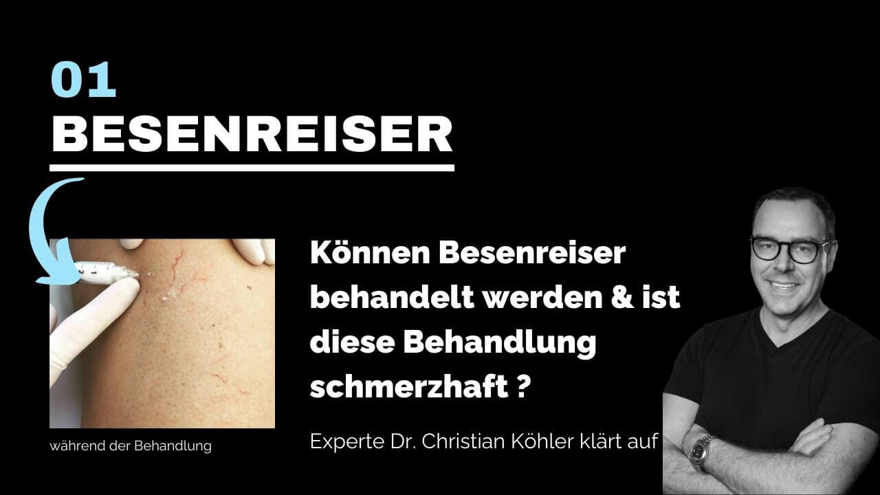 Besenreiser entfernen, prevention-center für Schönheitschirurgie in Zug